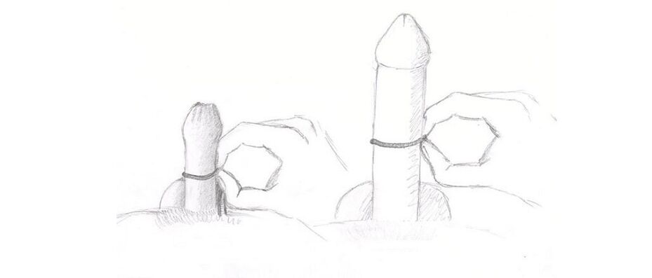 measurement of penis thickness